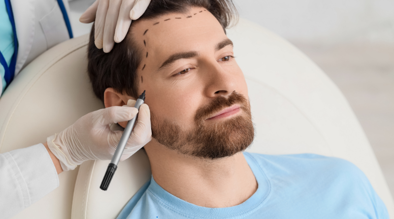 juiste haartransplantatie kliniek